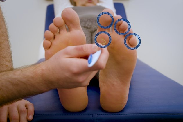 Diabetic foot care