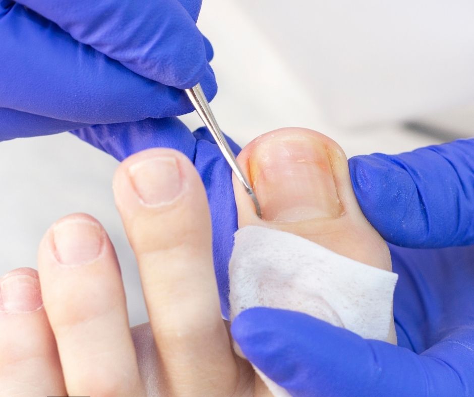 Nail cutting and filing