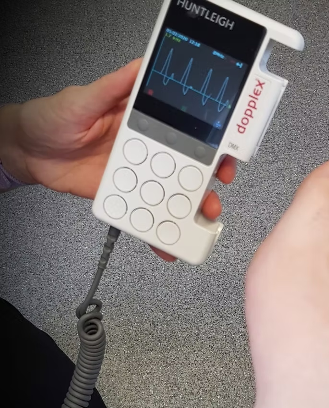 Neuro vascular assessment